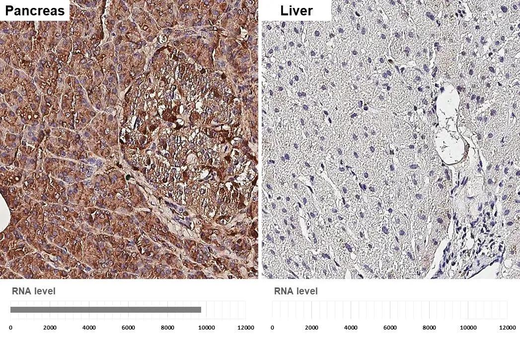 Elastase Antibody (HL2882)