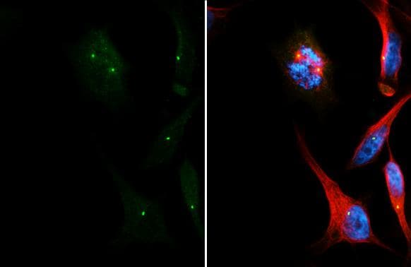 CEP152 Antibody (HL2884)