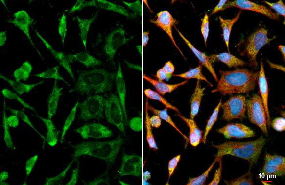 Ataxin-2 Antibody (HL2885)