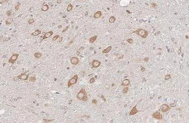 Ataxin-2 Antibody (HL2885)
