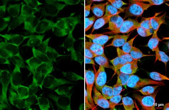Ataxin-2 Antibody (HL2886)