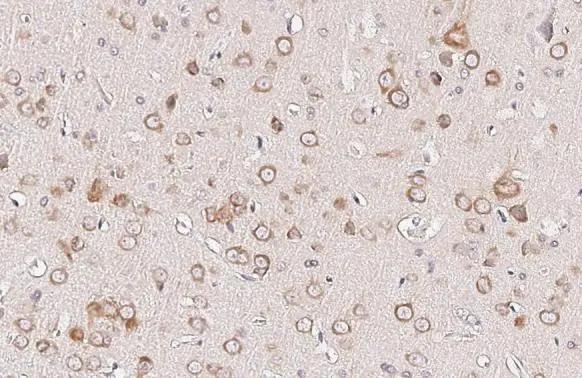 Ataxin-2 Antibody (HL2886)