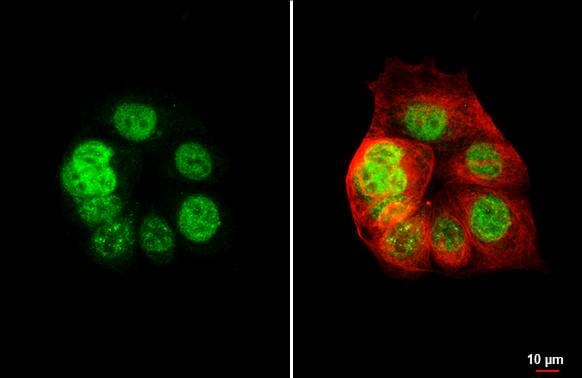 XPC Antibody (HL2892)