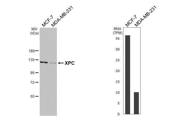 XPC Antibody (HL2892)