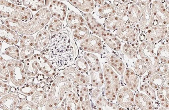 XPC Antibody (HL2894)