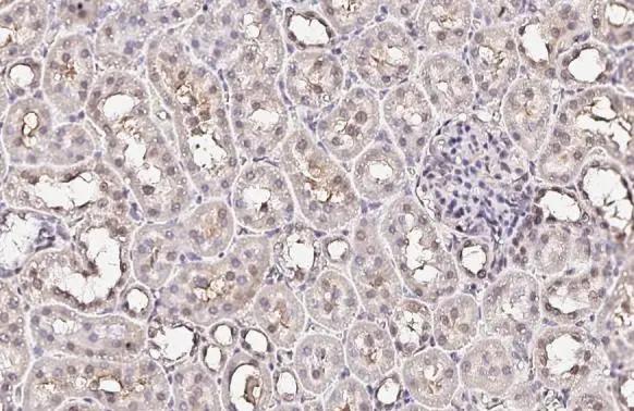 XPC Antibody (HL2894)