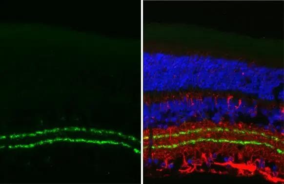 VAChT/SLC18A3 Antibody (HL2900)