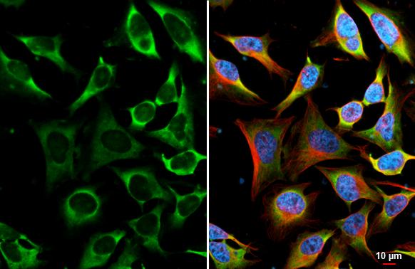 YTHDF2 Antibody (HL2910)