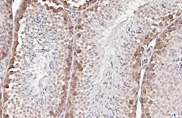 YTHDF2 Antibody (HL2910)