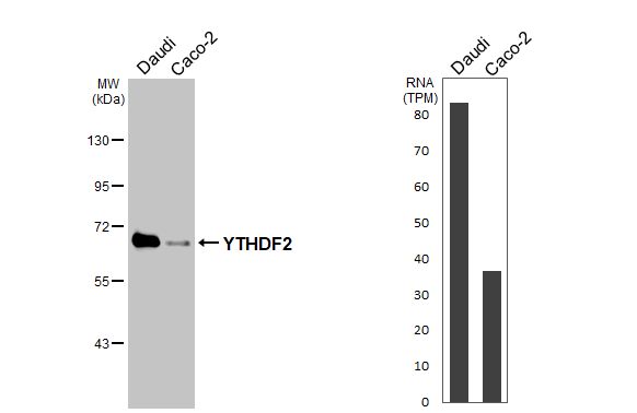 YTHDF2 Antibody (HL2910)