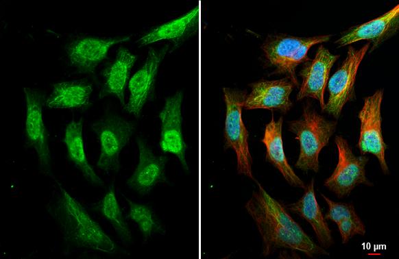 AKT Antibody (HL2915)