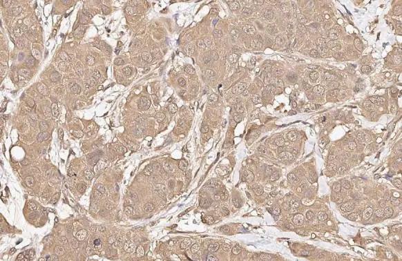 AKT Antibody (HL2915)