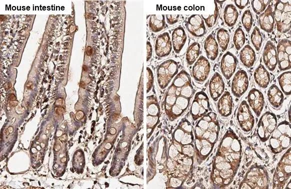 AKT Antibody (HL2915)