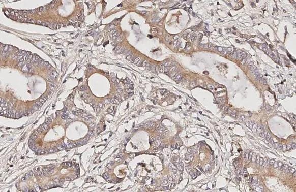 Somatostatin R4/SSTR4 Antibody (HL2933)