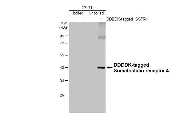 Somatostatin R4/SSTR4 Antibody (HL2933)