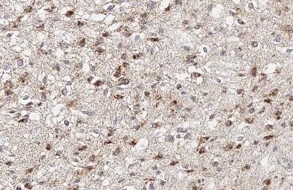 ATP5J Antibody (HL2934)