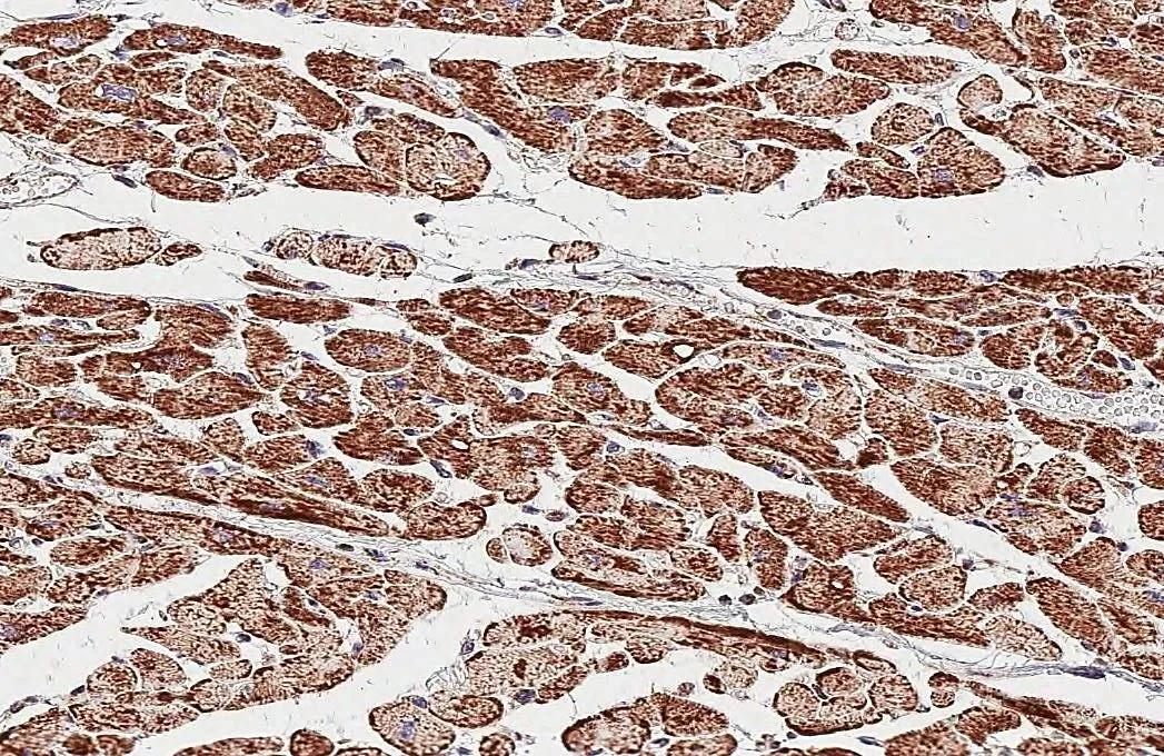 ATP5J Antibody (HL2934)