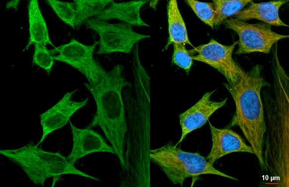 Flightless I Antibody (HL2965)