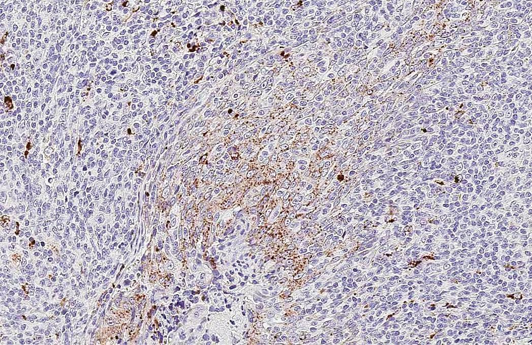 RGS2 Antibody (HL2988)