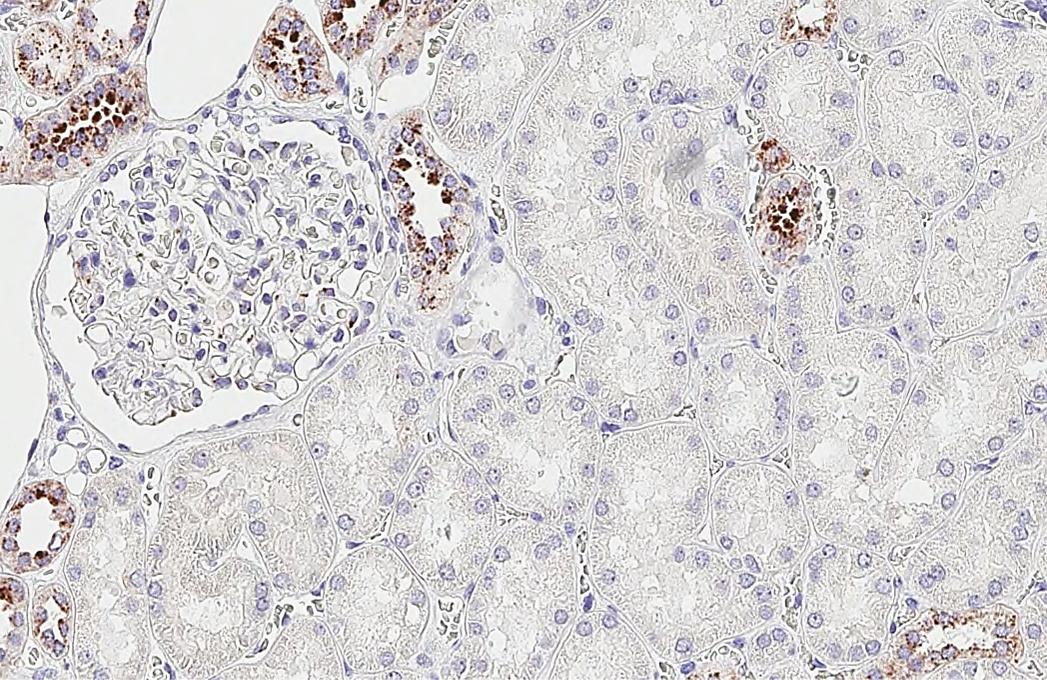 RGS2 Antibody (HL2988)