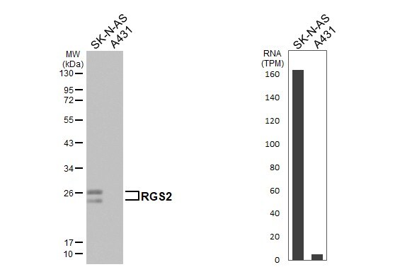 RGS2 Antibody (HL2988)