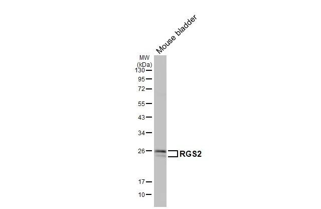 RGS2 Antibody (HL2988)