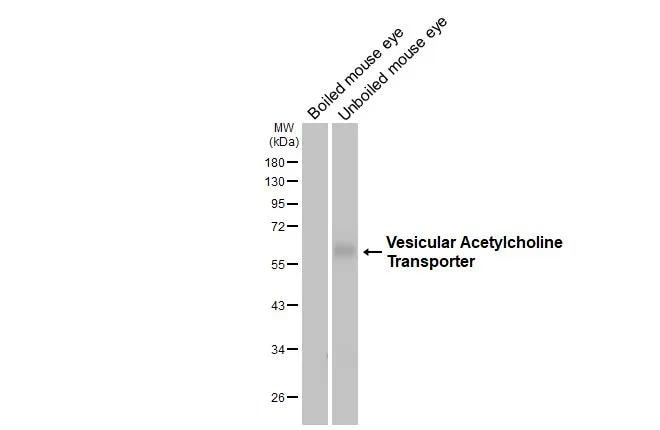 VAChT/SLC18A3 Antibody (HL3053)
