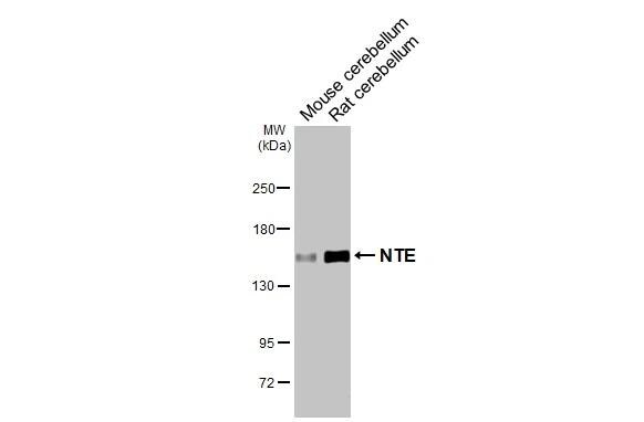PNPLA6 Antibody (HL3127)