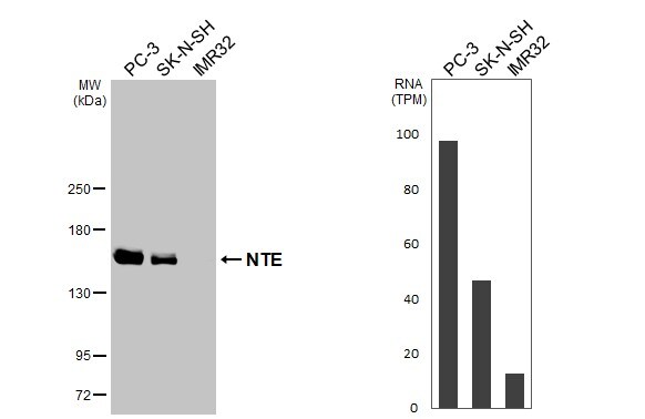 PNPLA6 Antibody (HL3127)
