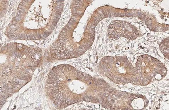 Melanocortin-4 R Antibody (HL3145)