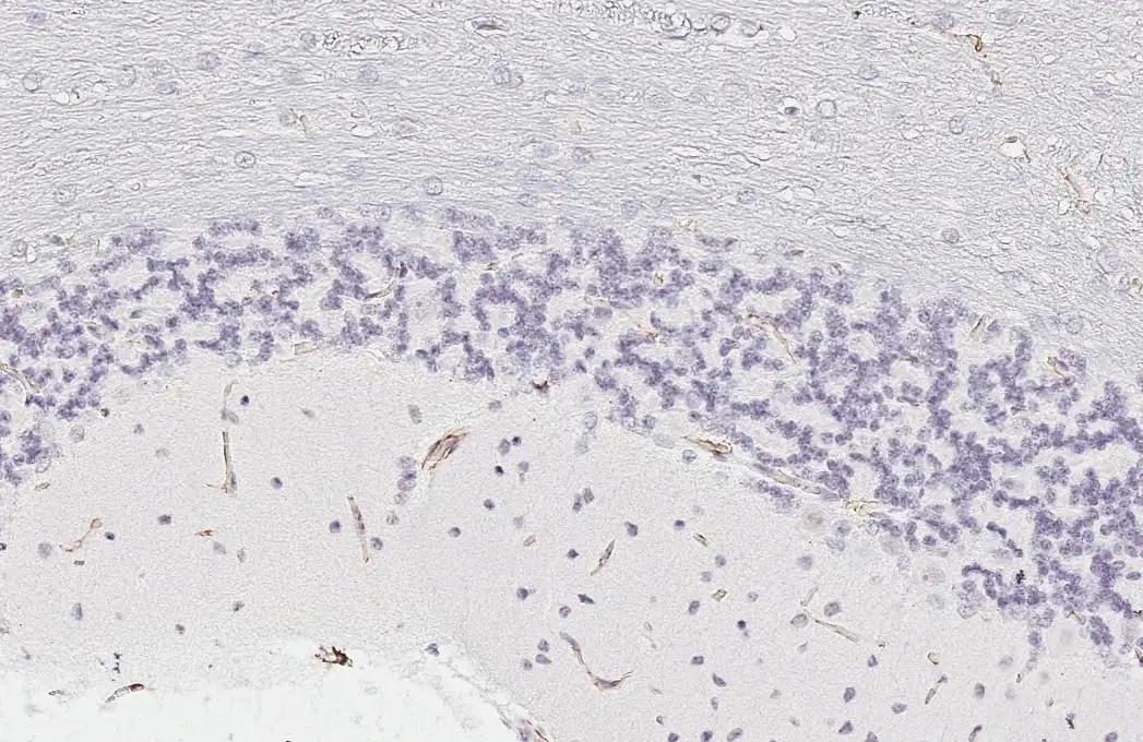 Claudin-5 Antibody (HL3156)