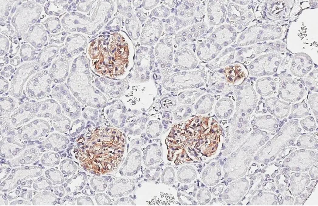Claudin-5 Antibody (HL3156)