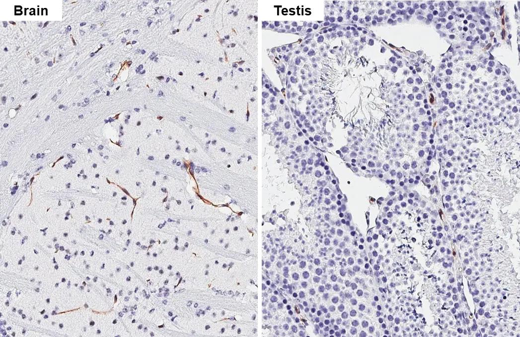 Claudin-5 Antibody (HL3156)