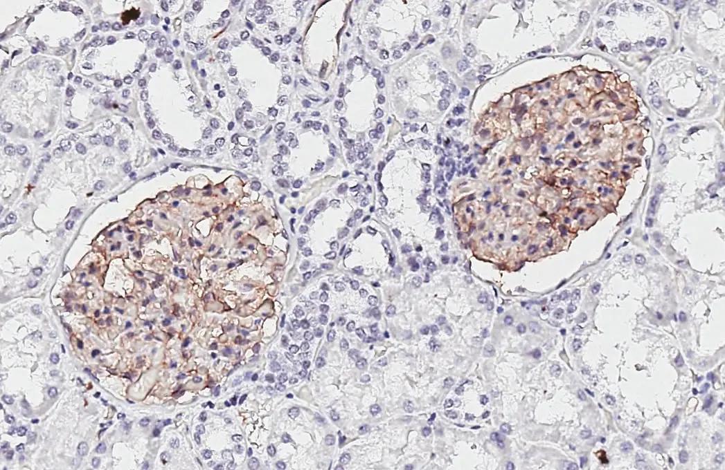 Claudin-5 Antibody (HL3156)