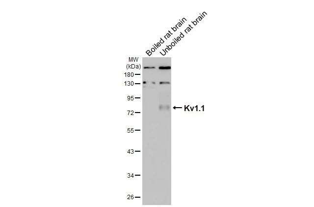 Kv1.1 Antibody (HL3162)