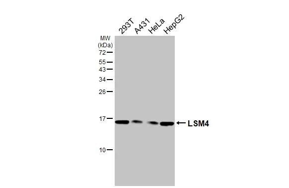 LSM4 Antibody (HL3172)