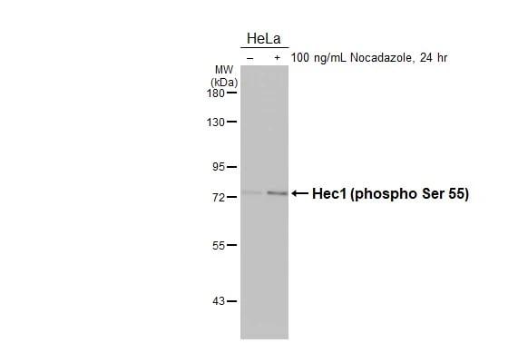 NDC80 [p Ser55] Antibody (HL3190)