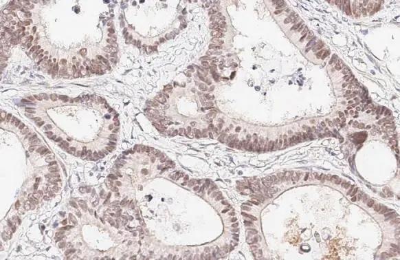 HNF1 Antibody (HL3229)