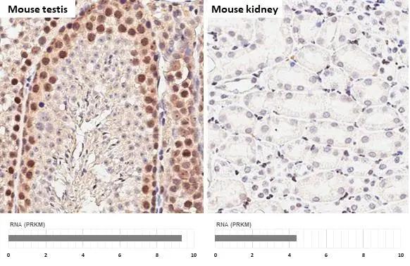SETDB1 Antibody (HL3259)