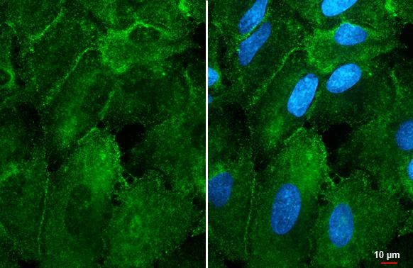 alpha-1D Adrenergic R/ADRA1D Antibody (HL3267)