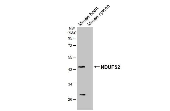 NDUFS2 Antibody (HL3269)
