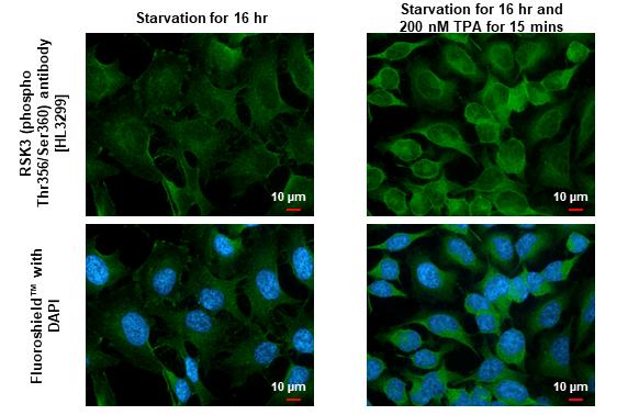 RSK3 [p Ser360, p Thr356] Antibody (HL3299)