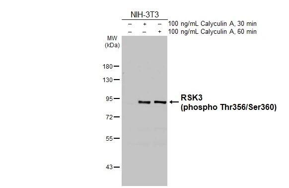 RSK3 [p Ser360, p Thr356] Antibody (HL3299)