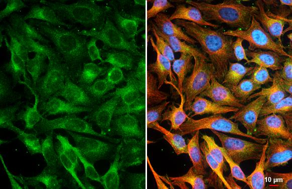 CASK Antibody (GT27)