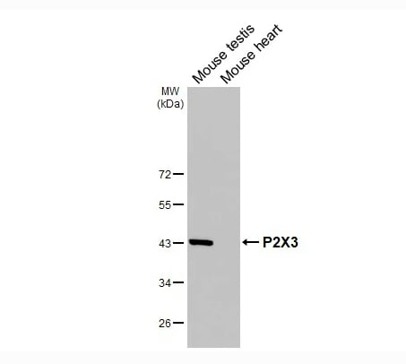 P2X3/P2RX3 Antibody (HL3347)