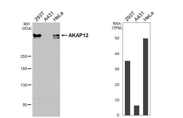 AKAP12 Antibody (HL3364)