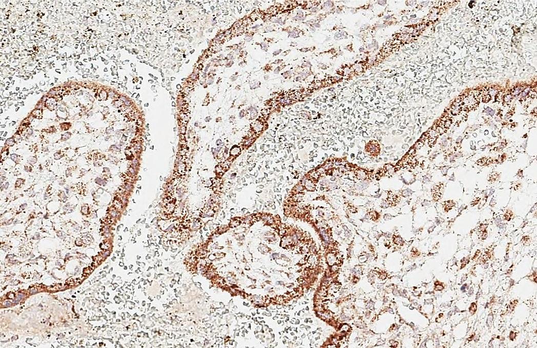 PLK4 Antibody (HL3371)