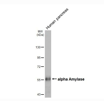 Alpha Amylase Antibody (HL1681)