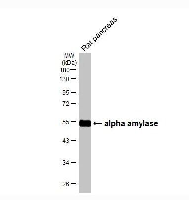 Alpha Amylase Antibody (HL1681)
