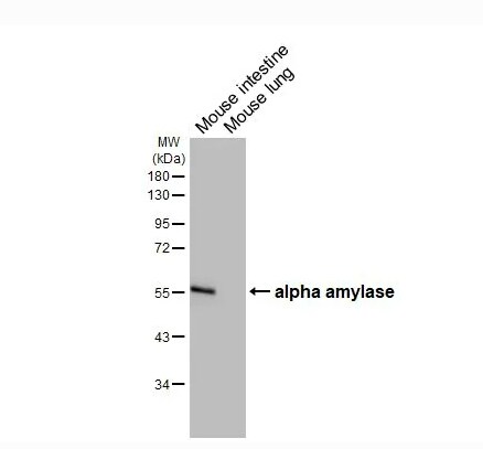 Alpha Amylase Antibody (HL1681)